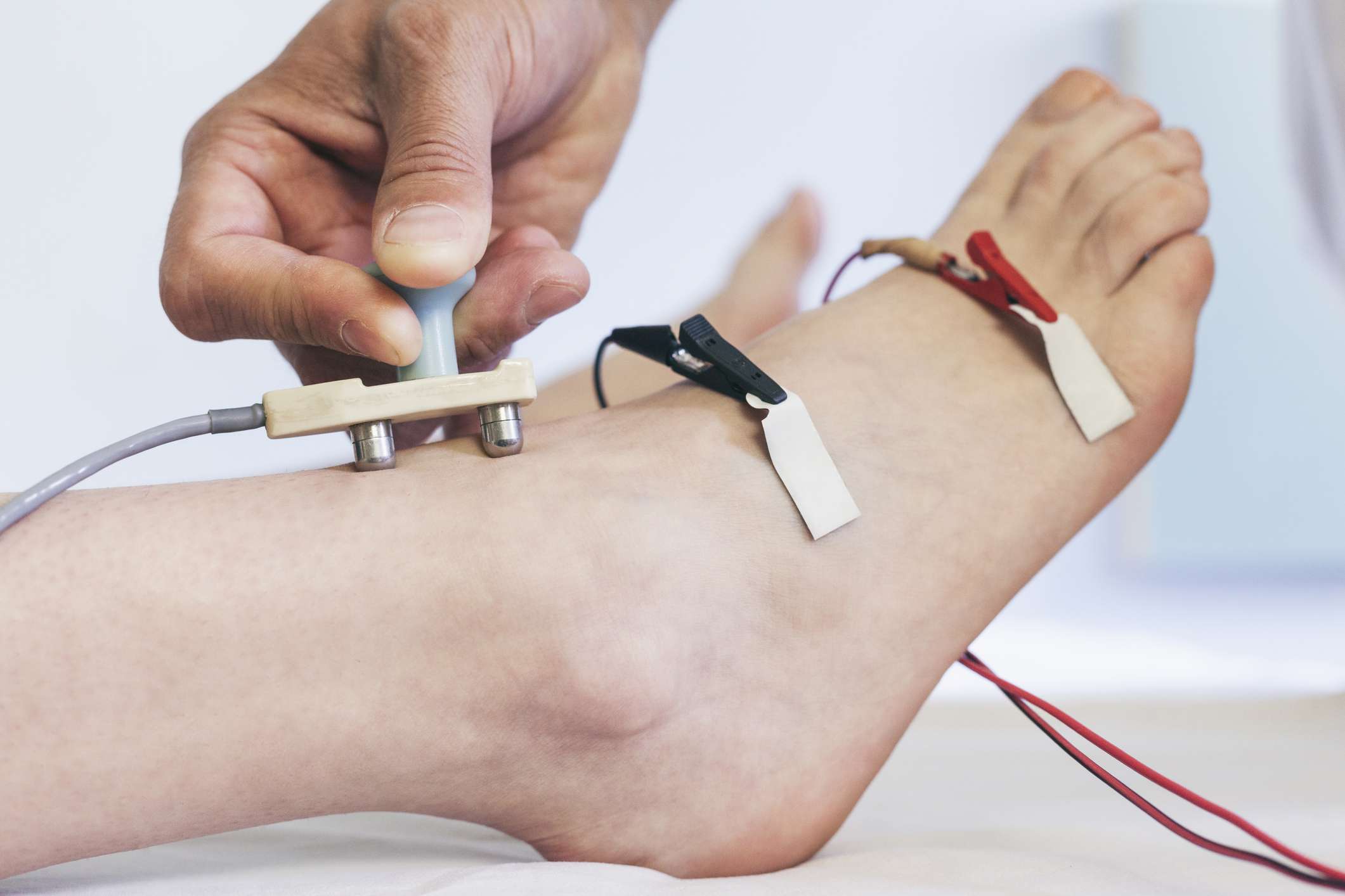 nerve conduction test